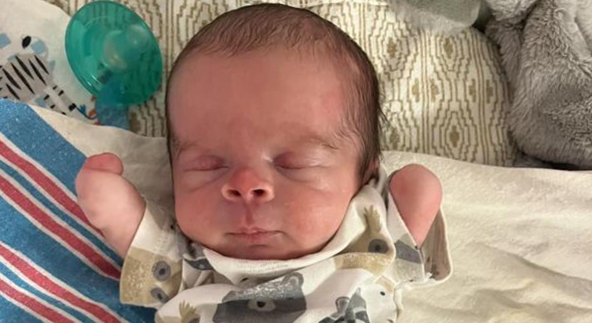 Incredible Strength: How Baby Bryson Cox Thrives Without Arms or Legs